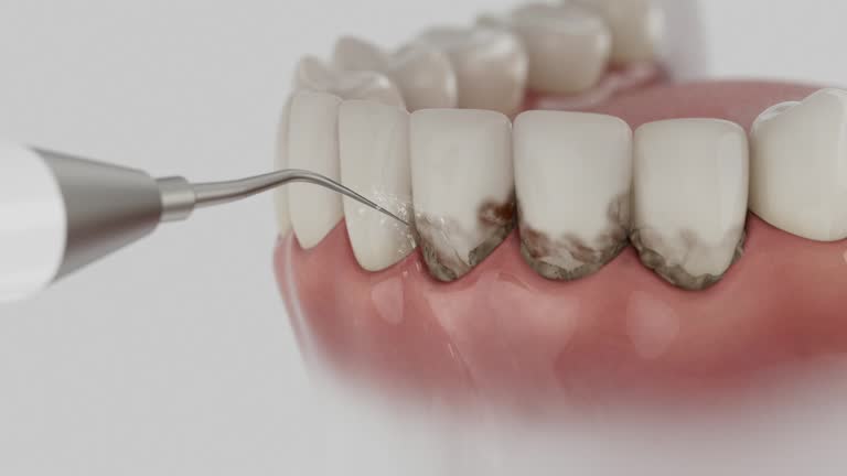 Reliable Tooth Extraction contractor in Turner County County, GA by Dentist Open Now